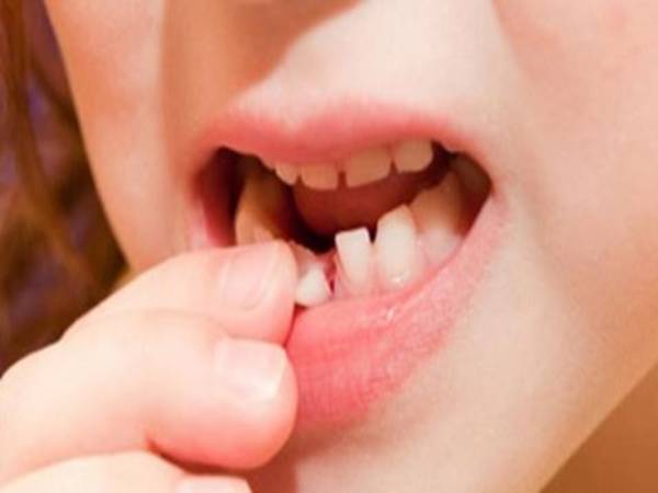 Mơ thấy rụng răng có điềm báo gì và đánh số nào trúng?