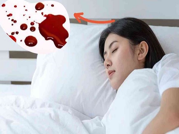 Nằm mơ thấy máu kinh nguyệt thử vận may với con gì