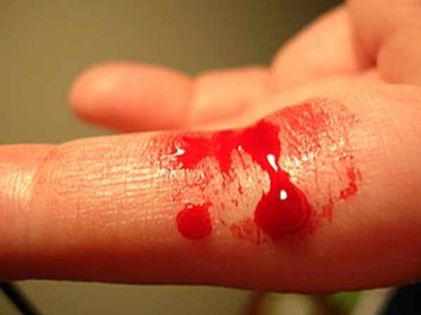 Mơ thấy dao làm đứt tay chảy máu